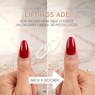 Clear - Perfect Flex Rubber Base Coat 10ml LYNIS NAILS